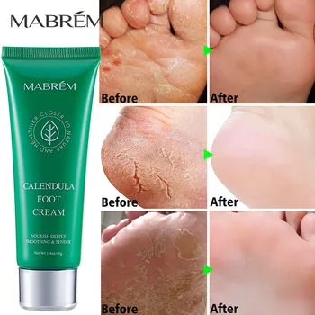 2PCS/LOT MABREM קרם רגליים פדיקור יופי בריאות הרגל מסכת פילינג פדיקור תיקון העור ניקוי לחות לחות